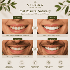 Before and after comparison of teeth and gums using Venora Miswak Toothbrush with natural elements.