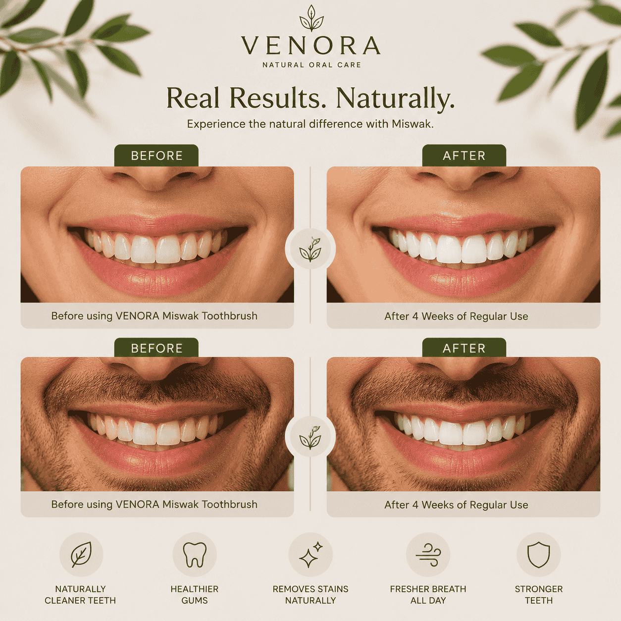 Before and after comparison of teeth and gums using Venora Miswak Toothbrush with natural elements.